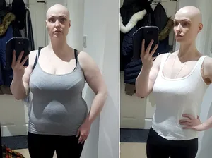 Puasa Medsos, Wanita Ini Bisa Turun Berat Badan 36 Kg!