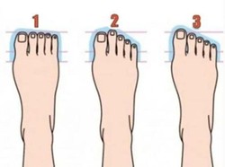 Tes: Ungkap Kepribadianmu dari Bentuk Kaki yang Kamu Miliki