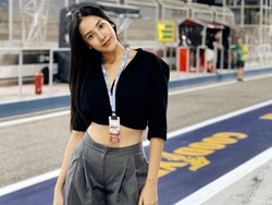 Anya Geraldine Terbaring di RS, Siap untuk Operasi