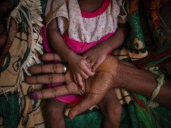 Daftar 10 Negara Termiskin di Dunia 2023 Versi Bank Dunia