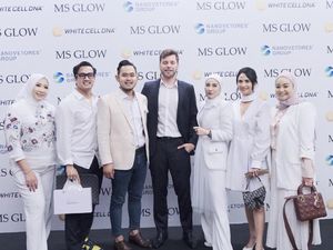 Vanessa Angel Meninggal Kecelakaan, Bos MS Glow Ungkap Kesan Terakhir Bertemu