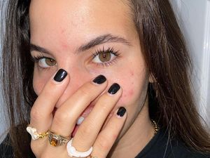 Kisah Model yang Wajahnya Rusak Diserang Anjing, Bibir dan Hidungnya Robek