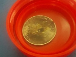 Sebulan Nyangkut, Koin di Tenggorokan Bocah Fatan Brebes Berhasil Diambil