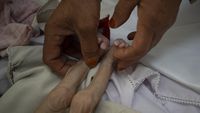 Pilu Anak-anak di Afghanistan Kekurangan Gizi hingga Kelaparan