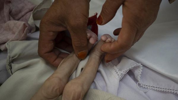 Pilu Anak-anak di Afghanistan Kekurangan Gizi hingga Kelaparan