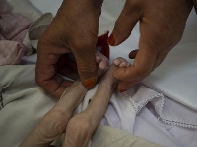 Pilu Anak-anak di Afghanistan Kekurangan Gizi hingga Kelaparan
