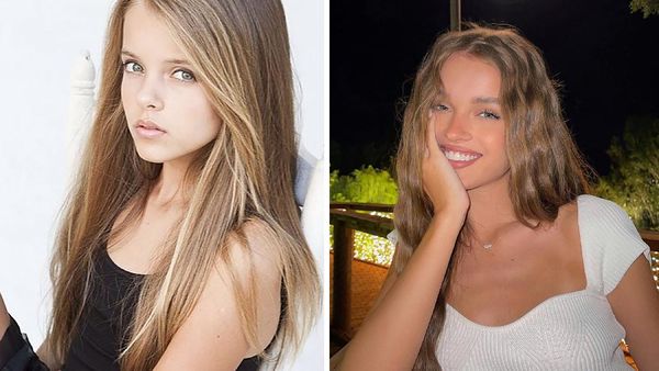Foto 10 Wanita Cantik yang Viral Saat Kecil, Begini Penampilannya Sekarang
