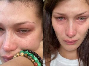 Bella Hadid Unggah Foto Nangis, Nggak Sangka Ini yang Tiap Hari Dialaminya