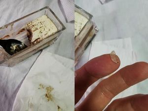 Ngeri! Lidah Pria Ini Tergores Kaca Saat Asyik Ngemil Tiramisu