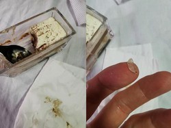 Ngeri! Lidah Pria Ini Tergores Kaca Saat Asyik Ngemil Tiramisu