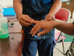 Saat Cincin Kawin Jadi Masalah Karena Terlalu Lama Melingkar di Jari