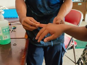 Saat Cincin Kawin Jadi Masalah Karena Terlalu Lama Melingkar di Jari Saat Cincin Kawin Jadi Masalah Karena Terlalu Lama Melingkar di Jari