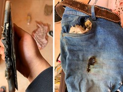 Ponsel Meledak di Saku Celana, Remaja Dilarikan ke RS