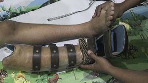 Raup Cuan Puluhan Juta Lewat Pembuatan Kaki Palsu