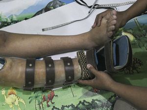 Raup Cuan Puluhan Juta Lewat Pembuatan Kaki Palsu Raup Cuan Puluhan Juta Lewat Pembuatan Kaki Palsu