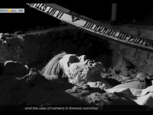 Unair Punya Museum Kematian, Ini 5 Hal yang Bisa Dipelajari di Sini