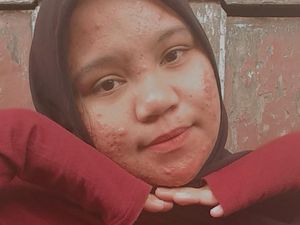 Kisah Pejuang Jerawat, Rela Nggak Jajan dan Jalani Ruqiah Demi Wajah Mulus Kisah Pejuang Jerawat, Rela Nggak Jajan dan Jalani Ruqiah Demi Wajah Mulus