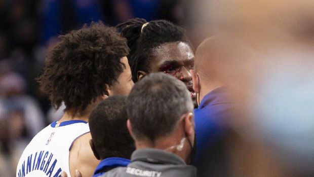 Nov 21, 2021; Detroit, Michigan, USA; Detroit Pistons center Isaiah Stewart (28) has blood around his right eye after an altercation with Los Angeles Lakers forward LeBron James (not pictured) during the third quarter at Little Caesars Arena. Mandatory Credit: Raj Mehta-USA TODAY Sports