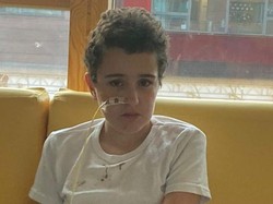 Kasihan! Gegara COVID-19, Bocah Ini Sebut Semua Makanan Rasanya Mirip Telur Busuk