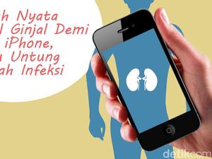 Jual Ginjal demi iPhone, Malah Buntung Gegara Infeksi Parah