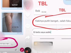 Viral Pasien Konsultasi Online, Dokter Malah Komentari Kakinya: Putih Banget