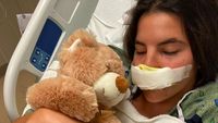 8 Foto Penampakan Model yang Tak Punya Bibir Setelah Diserang Anjing Pitbull