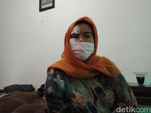 Saksi Kunci Kasus Suap di Liga 3 Jadi Korban Tabrak Lari