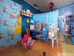 Kisah Bocah 2 Tahun Anak Nelayan Cilincing Alami Kelainan Alat Kelamin