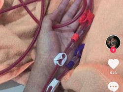 Gegara Tak Suka Minum Air Putih, Wanita Ini Harus Rutin Cuci Darah