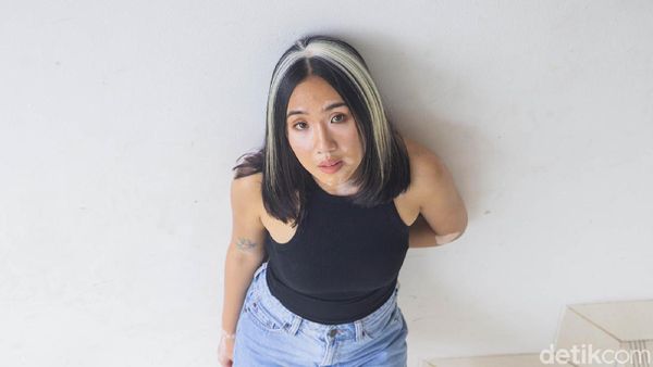 9 Pesona Zsazsa Caesar, Model Inspiratif yang Ubah Stigma Vitiligo