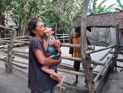 Begini Kondisi Kakak Beradik di Jember Kelainan Genetik Sejak Lahir