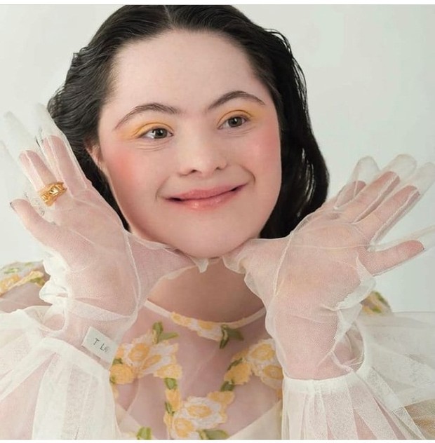 Ellie Goldstein menjadi model dengan down syndrome untuk Gucci Beauty