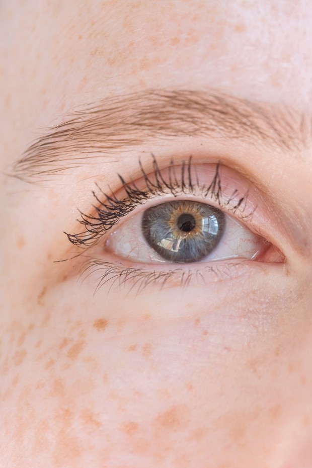 Ilustrasi kulit sensitif/Foto: Pexels/Angela Roma