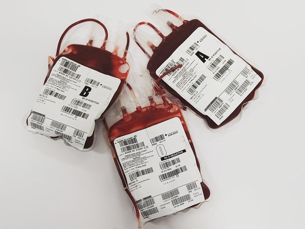 Penularan HIV bisa terjadi melalui transfusi darah/Foto: Pexels.com/Charlie-Helen Robinson