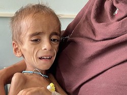 Kisah Pilu Bayi-bayi Afghanistan Kelaparan Akibat Krisis