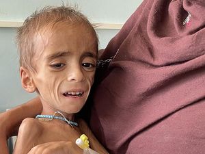 Kisah Pilu Bayi-bayi Afghanistan Kelaparan Akibat Krisis Kisah Pilu Bayi-bayi Afghanistan Kelaparan Akibat Krisis