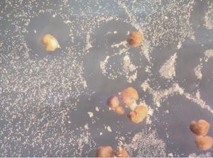 Xenobot, Robot Pertama di Dunia yang Bisa Bereproduksi