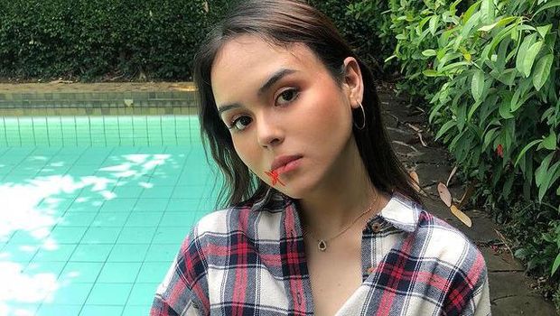 Laura Anna tuntut mantan kekasihnya Gaga Muhammad usai kecelakaan 2 tahun lalu yang menyebabkan ia lumpuh total. Yuk intip potretnya!