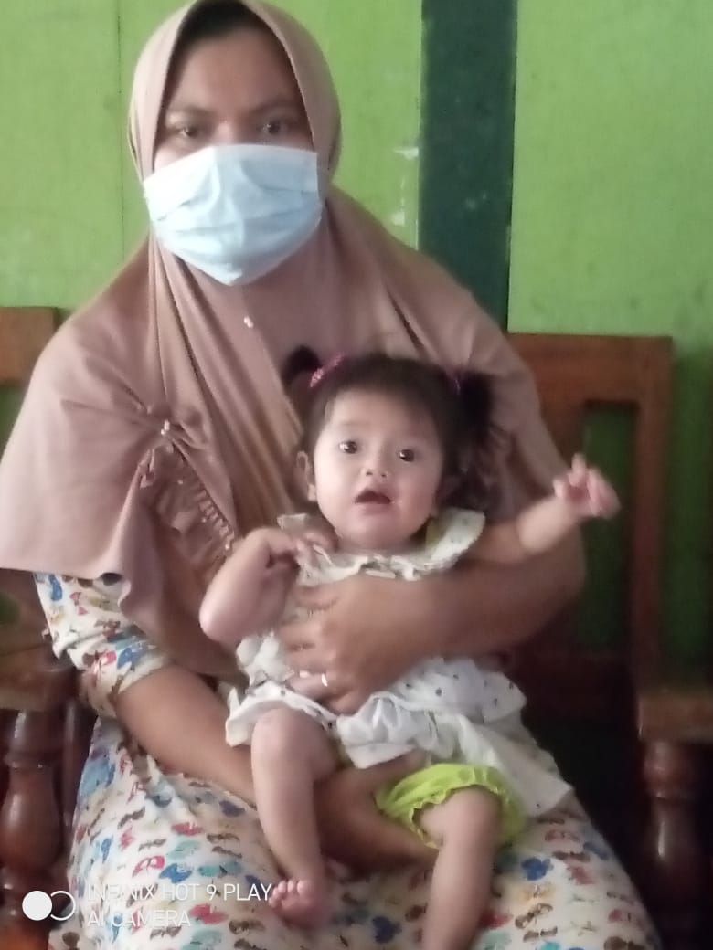 Bayi Eliza menderita kelainan kulit langka (campaign donasi BerbuatBaik)