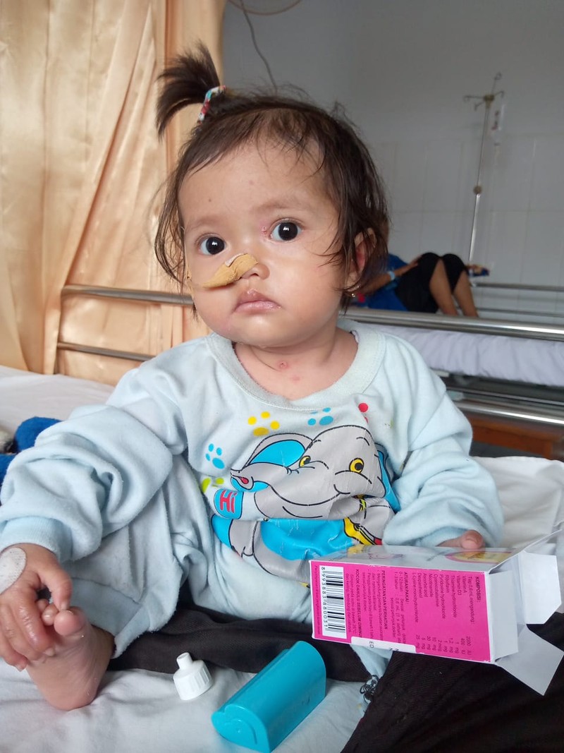 Kulit Melepuh karena Kelainan Langka, Bayi Eliza Menanti Uluran Tanganmu