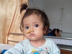 Tolong! Kulit Bayi Eliza Kerap Melepuh karena Penyakit Langka