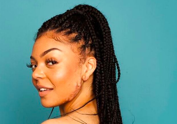 IlustrasiKeloid/Foto: Pinterest/Allure IlustrasiKeloid/Foto: Pinterest/Allure