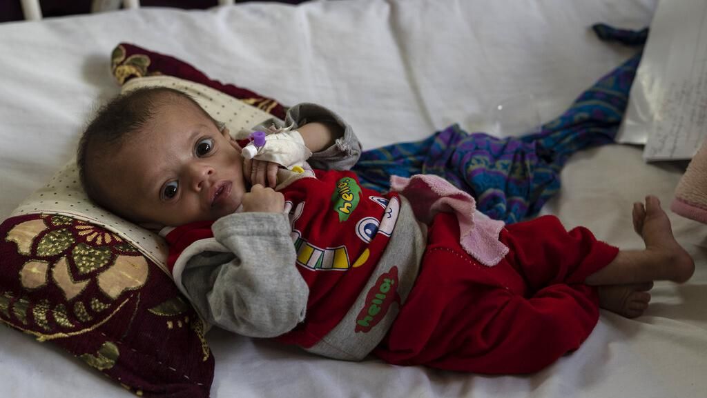Bayi-bayi Afghanistan Terjangkit Gizi Buruk Pasca Taliban Berkuasa