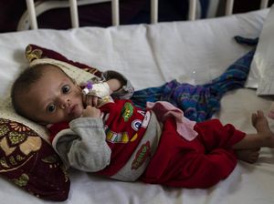Bayi-bayi Afghanistan Terjangkit Gizi Buruk Pasca Taliban Berkuasa