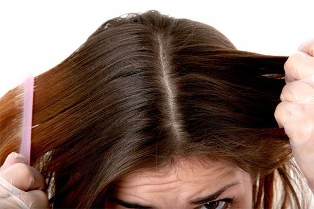 Ilustrasi rambut gatal/Pinterest.com/Women Online Magazine