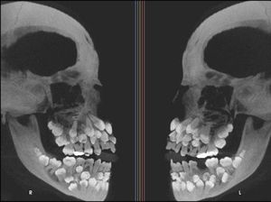 Ngilu! Begini Potret Hasil Sinar X Ray di Dalam Tubuh
