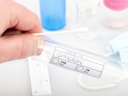 Patologi Klinik RS UNS Tegaskan Omicron Belum Masuk Indonesia!