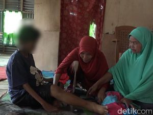 Tolong! Bocah di Sulbar Alami Sakit Langka hingga Perutnya Membesar