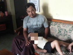 Balita di Pasuruan Disunat Jin, Satu Keluarga Panik