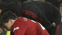 Ia diduga habis berbenturan dengan pemain lawan. (Foto: AP/Rui Vieira)